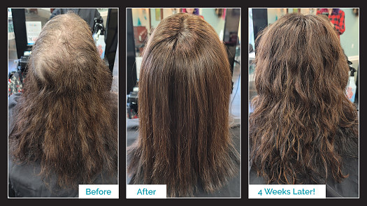 Topper Hair Replacement Installation - Before & After - By Kristan Sayers | K Bella - Brighton, MI