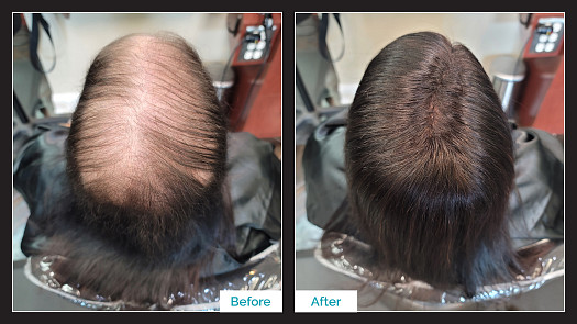 Toupee Hair Replacement - Before & After - By Kristan Sayers | K Bella - Brighton, MI