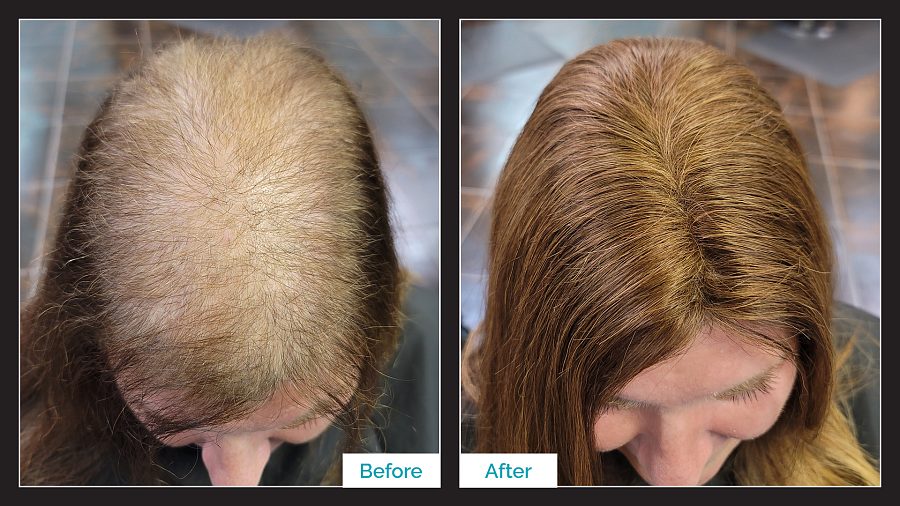 Topper Transformation - Before & After